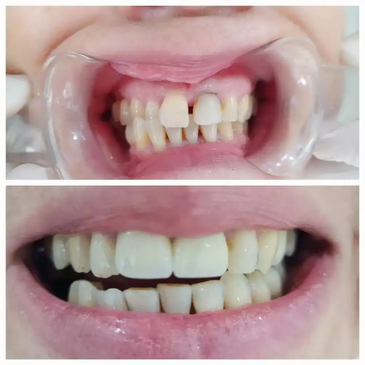 Slider image (6) Prestij Dental Clinic
